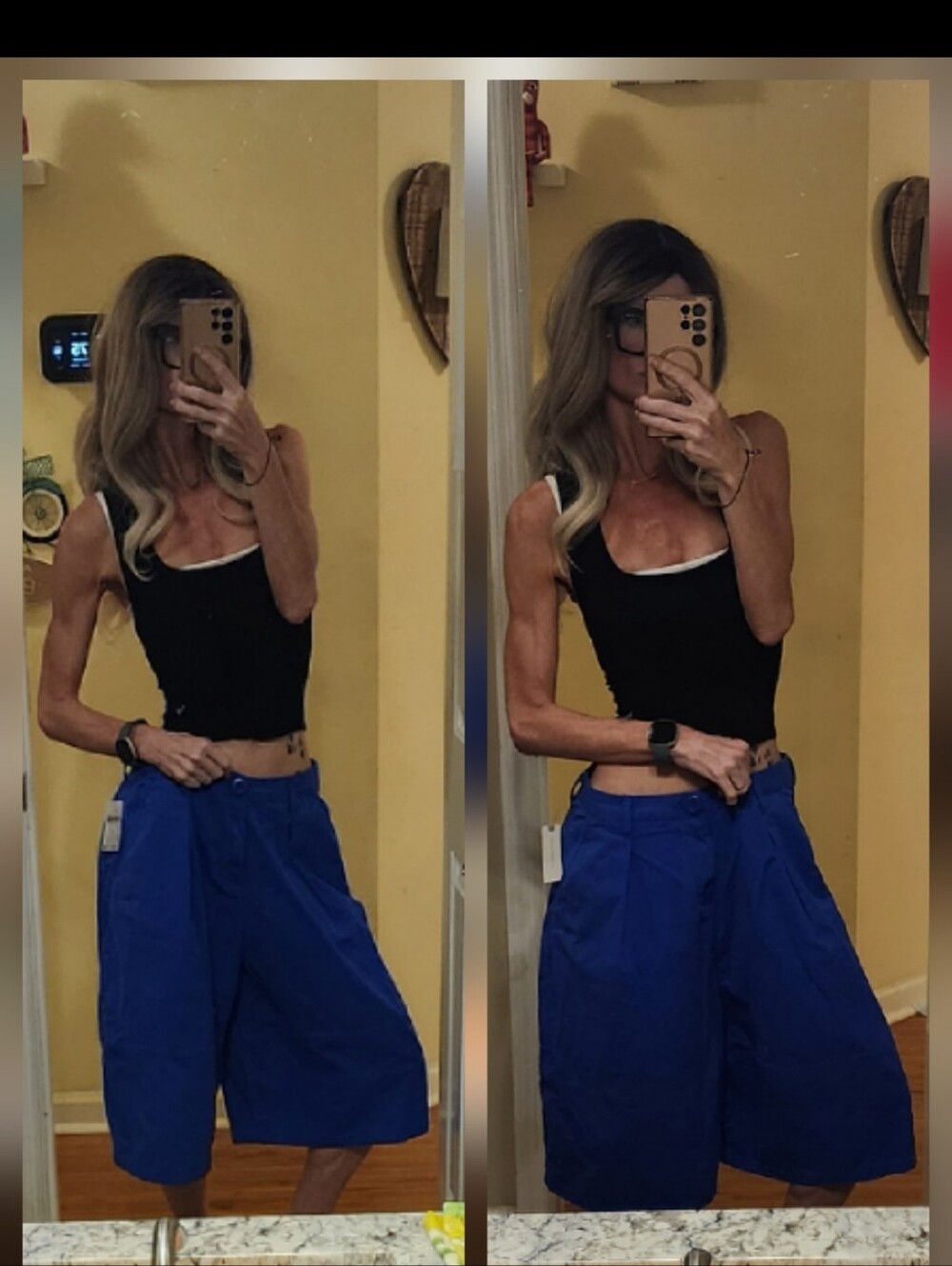 Anthropologie NWT Balloon Barrel Curved Horseshoe Shorts RUN BIG